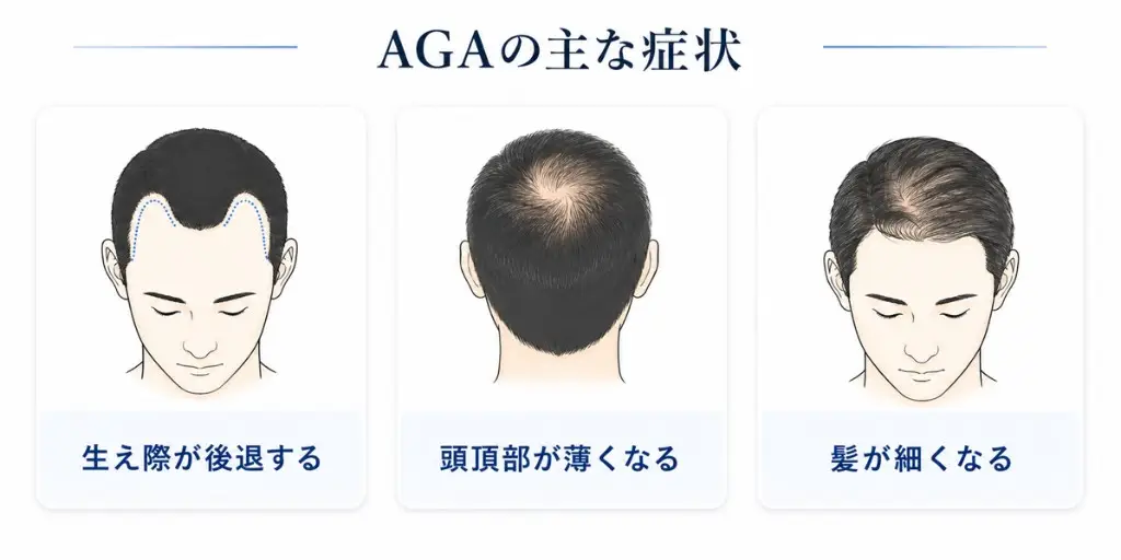 AGA（男性型脱毛症）についてのイメージ画像