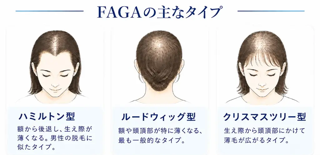 FAGA・FPHL（女性型脱毛症）についてのイメージ画像