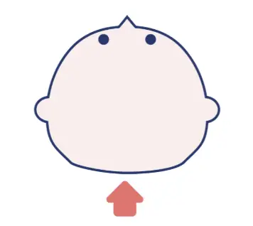 短頭症（たんとうしょう）のイメージ画像