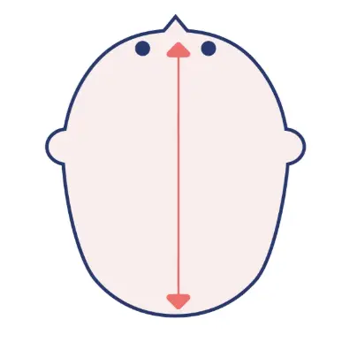 長頭症（ちょうとうしょう）のイメージ画像