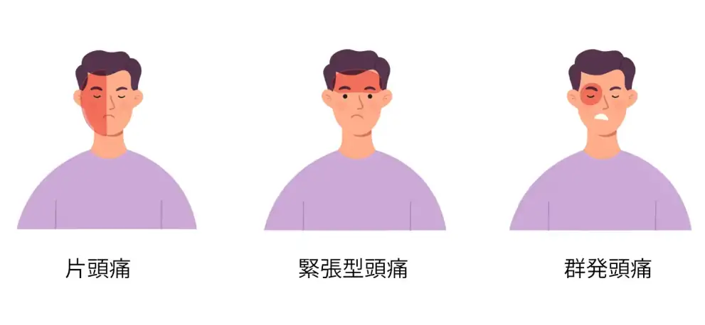 代表的な頭痛の種類のイメージ画像