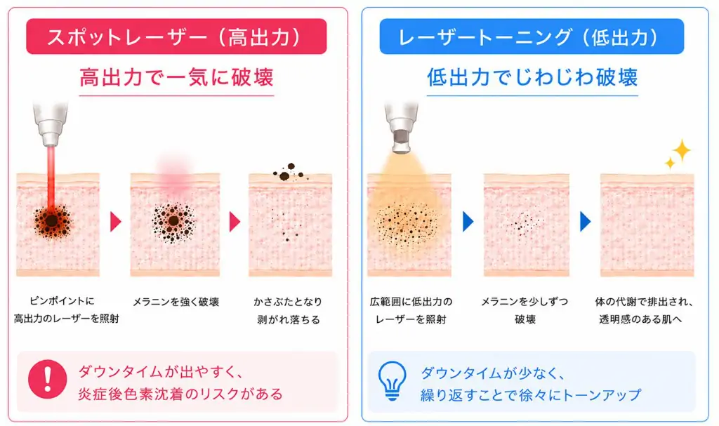 スポットレーザーとレーザートーニングの違い
