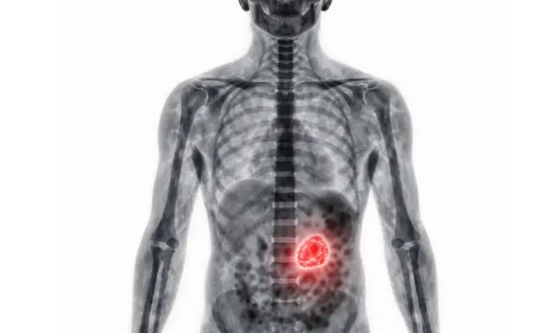 全身がんスクリーニング