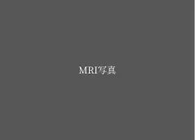 シアター付きMRI