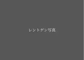 デジタルレントゲン